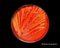 streptococcus pyogenes